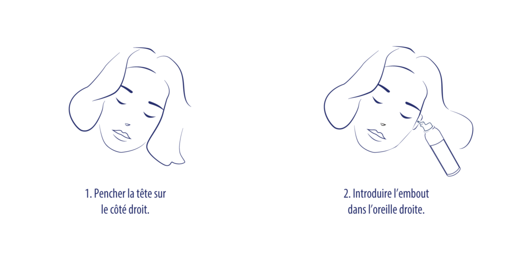 illustration utilisation reverse 1