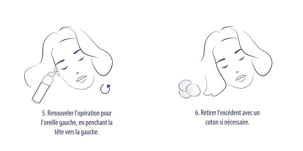 illustration utilisation reverse 3